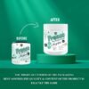Pro 360 Nephro LP - Non-Dialysis Care Nutritional Protein Drink (Vanilla Flavour) No Added Sugar, Special Dietary Supplement for Kidney/Renal Health, 400 Gm
